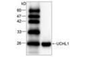 Image no. 1 for anti-Ubiquitin Carboxyl-terminal Esterase L1 (Ubiquitin Thiolesterase) (UCHL1) antibody (ABIN791511) (UCHL1 抗体)
