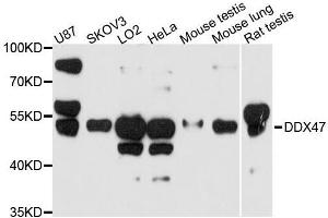 Western blot analysis of extracts of various cell lines, using DDX47 antibody. (DDX47 抗体  (AA 186-455))
