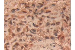 Immunohistochemistry (IHC) image for anti-Ubiquitin Carboxyl-terminal Esterase L1 (Ubiquitin Thiolesterase) (UCHL1) (AA 2-223) antibody (ABIN7436390)