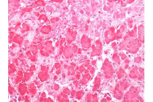 Human Adrenal: Formalin-Fixed, Paraffin-Embedded (FFPE) (G Protein-Coupled Receptor 133 抗体  (C-Term))