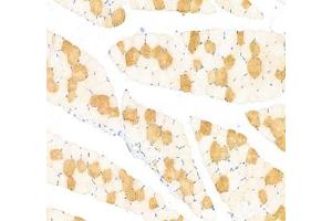Immunohistochemistry analysis of paraffin-embedded rat leg muscle using,MYH7 (ABIN7075623) at dilution of 1: 1000