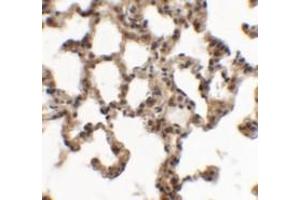 Immunohistochemical analysis of SPINK7 in rat lung tissue with SPINK7 polyclonal antibody  at 5 ug/mL.