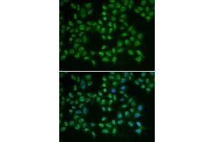 Immunofluorescence analysis of HeLa cells using BTK antibody (ABIN5970757). (BTK 抗体)