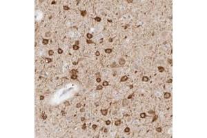 Immunohistochemical staining of human cerebral cortex with C9orf50 polyclonal antibody  shows strong cytoplasmic positivity in neurons. (C9ORF50 抗体)