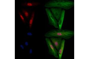 ABIN6266003 and ABIN6278719 staining  cells by IF/ICC.