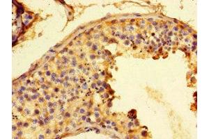 Immunohistochemistry of paraffin-embedded human testis tissue using ABIN7153916 at dilution of 1:100 (Glucose-6-Phosphate Dehydrogenase 抗体  (AA 80-185))