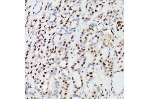Immunohistochemistry (IHC) image for anti-Cleavage and Polyadenylation Specific Factor 6, 68kDa (CPSF6) antibody (ABIN6138974)