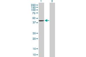 Western Blot analysis of SCCPDH expression in transfected 293T cell line by SCCPDH MaxPab polyclonal antibody. (SCCPDH 抗体  (AA 1-429))