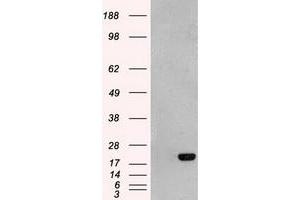 HEK293T cells were transfected with the pCMV6-ENTRY control (Left lane) or pCMV6-ENTRY AK1 (Right lane) cDNA for 48 hrs and lysed. (Adenylate Kinase 1 抗体)