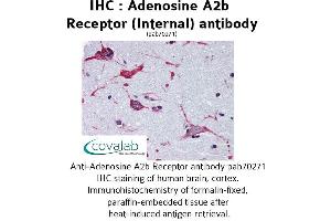 Image no. 1 for anti-Adenosine A2b Receptor (ADORA2B) (Internal Region) antibody (ABIN1731551) (Adenosine A2b Receptor 抗体  (Internal Region))