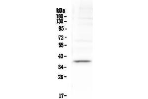 Western blot analysis of Tal1 using anti-Tal1 antibody . (TAL1 抗体  (AA 174-259))