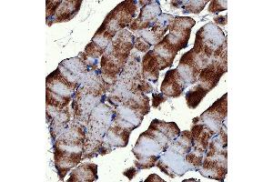 IHC analysis of RAB7/RAB7A using anti-RAB7/RAB7A antibody (ABIN7600597). (RAB7A 抗体  (AA 21-177))