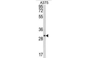 Western blot analysis of CTHRC1 Antibody (N-term) in A375 cell line lysates (35ug/lane). (CTHRC1 抗体  (N-Term))