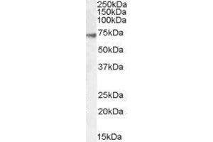 Western Blotting (WB) image for gamma-aminobutyric Acid (GABA) A Receptor, alpha 4 (GABRA4) peptide (ABIN368995) (gamma-aminobutyric Acid (GABA) A Receptor, alpha 4 (GABRA4) Peptide)