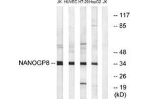 Western blot analysis of extracts from HuvEc/HT-29/HepG2/Jurkat cells, using NANOGP8 Antibody. (NANOGP8 抗体  (AA 51-100))