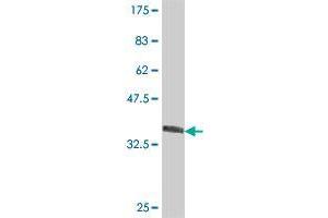 Western Blot detection against Immunogen (38. (DCAF10 抗体  (AA 1-110))