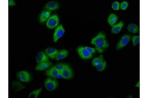Immunofluorescence (IF) image for anti-Potassium Inwardly-Rectifying Channel, Subfamily J, Member 5 (KCNJ5) (AA 348-419) antibody (ABIN7153289)