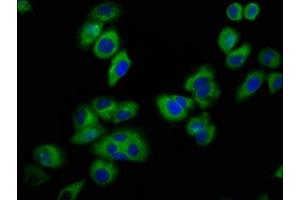 Immunofluorescence staining of A549 cells with ABIN7153289 at 1:100, counter-stained with DAPI. (KCNJ5 抗体  (AA 348-419))