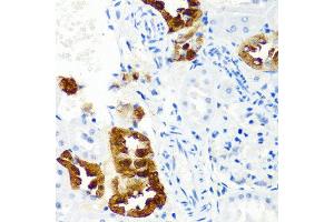 Immunohistochemistry of paraffin-embedded rat kidney using CST1 antibody at dilution of 1:100 (40x lens). (CST1 抗体)