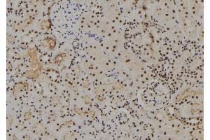 ABIN6273801 at 1/100 staining Rat kidney tissue by IHC-P. (NUAK2 抗体  (Internal Region))