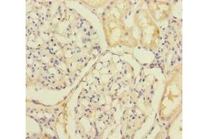Immunohistochemistry of paraffin-embedded human kidney tissue using ABIN7176692 at dilution of 1:100