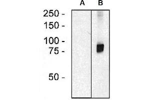 Western blotting analysis of ARHGEF4 in HEK293 cells (A) and HEK293-ARHGEF4 transfectants (B) using mouse monoclonal anti-ARHGEF4 (clone ARHGEF-08). (ARHGEF4 抗体  (AA 143-271) (PE))