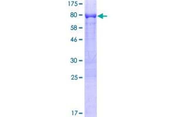 Retinoic Acid Receptor alpha Protein (AA 1-462) (GST tag)