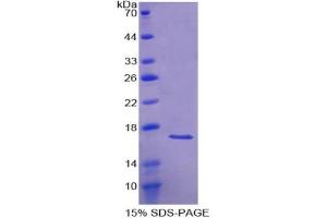 SDS-PAGE analysis of Human ACVR1 Protein. (ACVR1 蛋白)