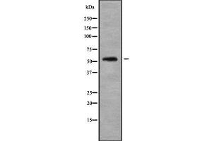 Western blot analysis of RASGEF1B using COLO205 whole cell lysates