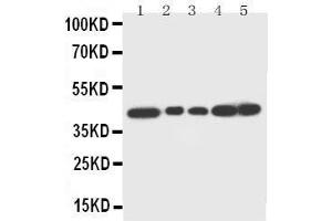 Anti-Decorin antibody, Western blotting Lane 1: Rat Liver Tissue Lysate Lane 2: Rat Lung Tissue Lysate Lane 3: Rat Spleen Tissue Lysate Lane 4: SMMC Cell Lysate Lane 5: SMMC Cell Lysate (Decorin 抗体  (C-Term))