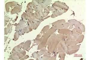 Immunohistochemistry (IHC) analysis of paraffin-embedded Human Muscle, antibody was diluted at 1:100. (SDHB 抗体  (Internal Region))