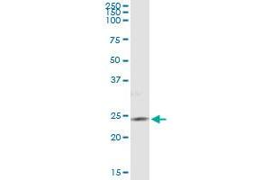 Immunoprecipitation (IP) image for anti-Phosphatidylinositol-4-Phosphate 5-Kinase, Type I, gamma (PIP5K1C) (AA 561-667) antibody (ABIN525139)