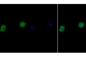Detection of IL10Ra in Human MCF7 cell using Polyclonal Antibody to Interleukin 10 Receptor Alpha (IL10Ra) (IL-10RA 抗体  (AA 132-235))