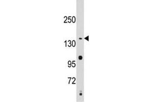 Western blot analysis of SMC2 antibody and Jurkat lysate. (SMC2 抗体  (AA 1166-1197))
