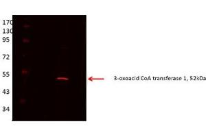 OXCT1 antibody - middle region  validated by WB using Proximal kidney tubules purfied from cortex at 1:1000. (OXCT1 抗体  (Middle Region))
