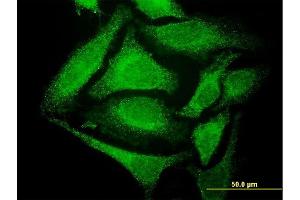 Immunofluorescence of monoclonal antibody to GCH1 on HeLa cell. (GCH1 抗体  (AA 1-250))