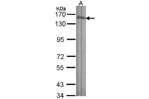 Western Blotting (WB) image for anti-Laminin, beta 3 (LAMB3) antibody (ABIN2855691)