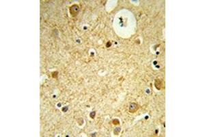 Formalin-fixed and paraffin-embedded human brain tissue reacted with RECK / ST15  Antibody  which was peroxidase-conjugated to the secondary antibody, followed by DAB staining. (RECK 抗体  (Middle Region))