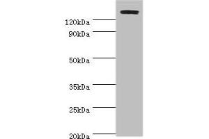 Western blot All lanes: TP53BP2 antibody at 2 μg/mL + Mouse thymus Secondary Goat polyclonal to rabbit IgG at 1/10000 dilution Predicted band size: 126, 112, 127 kDa Observed band size: 126 kDa (TP53BP2 抗体  (AA 360-600))