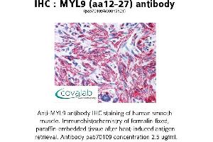 Image no. 1 for anti-Myosin Regulatory Light Chain 2, Smooth Muscle Isoform (MYL9) (AA 12-27) antibody (ABIN1737166)