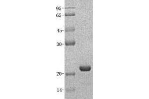 Validation with Western Blot (NCALD Protein (Transcript Variant 1) (His tag))