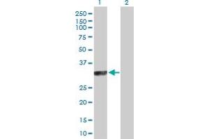 Western Blot analysis of SYCP3 expression in transfected 293T cell line by SYCP3 MaxPab polyclonal antibody. (SYCP3 抗体  (AA 1-236))