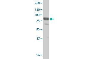 DVL3 monoclonal antibody (M04), clone 4H2 Western Blot analysis of DVL3 expression in A-431 . (DVL3 抗体  (AA 1-100))