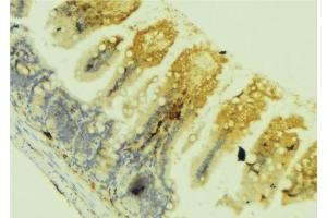 Immunohistochemistry (IHC) image for anti-Sema Domain, Immunoglobulin Domain (Ig), Short Basic Domain, Secreted, (Semaphorin) 3C (SEMA3C) (C-Term) antibody (ABIN6264976)
