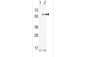 Western Blotting (WB) image for anti-Phosphatidylinositol-4-Phosphate 5-Kinase, Type I, alpha (PIP5K1A) (AA 19-50), (N-Term) antibody (ABIN392593)