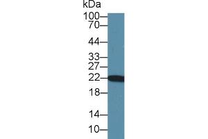 Western blot analysis of Rat Heart lysate, using Rat PARK7 Antibody (1 µg/ml) and HRP-conjugated Goat Anti-Rabbit antibody ( (PARK7/DJ1 抗体  (AA 1-189))