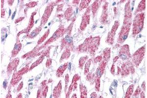 Human Heart: Formalin-Fixed, Paraffin-Embedded (FFPE) (ACAT1 抗体  (AA 218-267))
