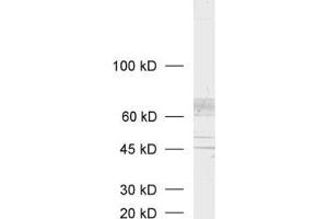 Western Blotting (WB) image for anti-Solute Carrier Family 18 (Vesicular Acetylcholine), Member 3 (SLC18A3) (AA 475-530), (C-Term) antibody (ABIN1742304)
