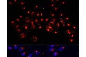 Immunofluorescence analysis of 293T cells using AARS Polyclonal Antibody at dilution of 1:100 (40x lens). (AARS 抗体)