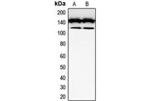 Western blot analysis of CD117 expression in SKNSH (A), Jurkat (B) whole cell lysates. (KIT 抗体  (Center))